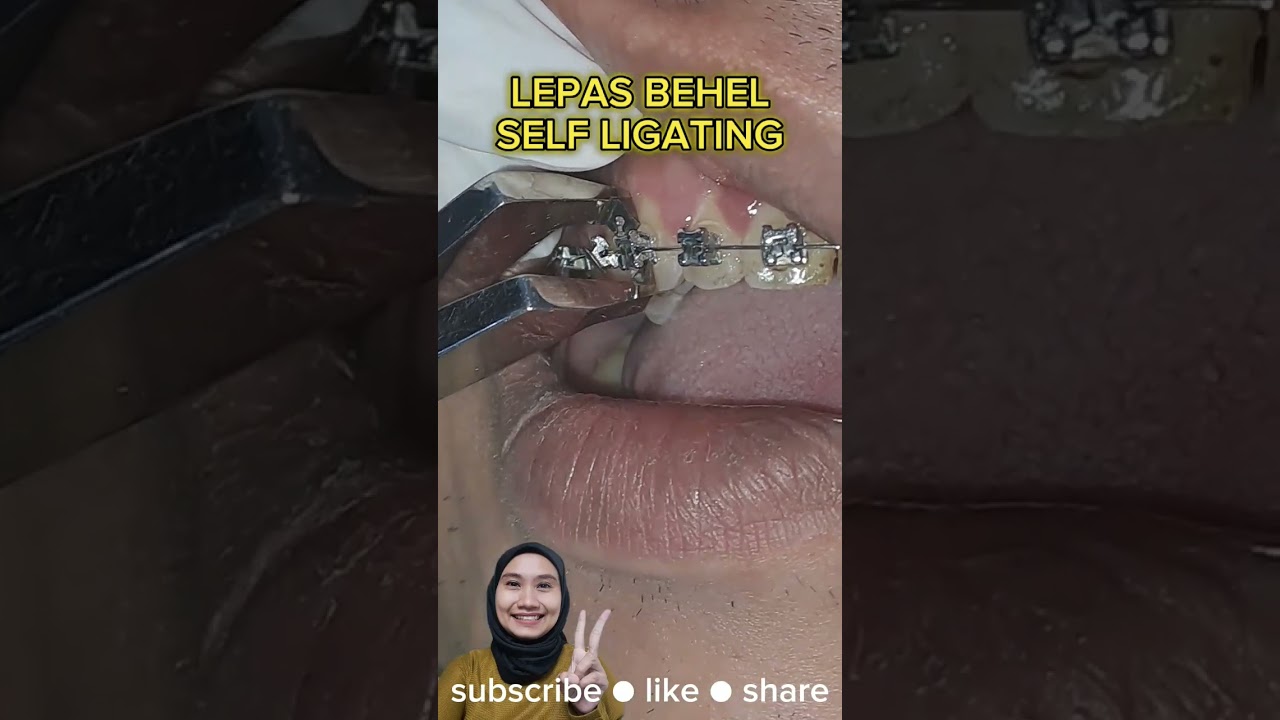 LEPAS BEHEL SELFLIGATING #behel #karetbehel #behelgigi #lepasbehel