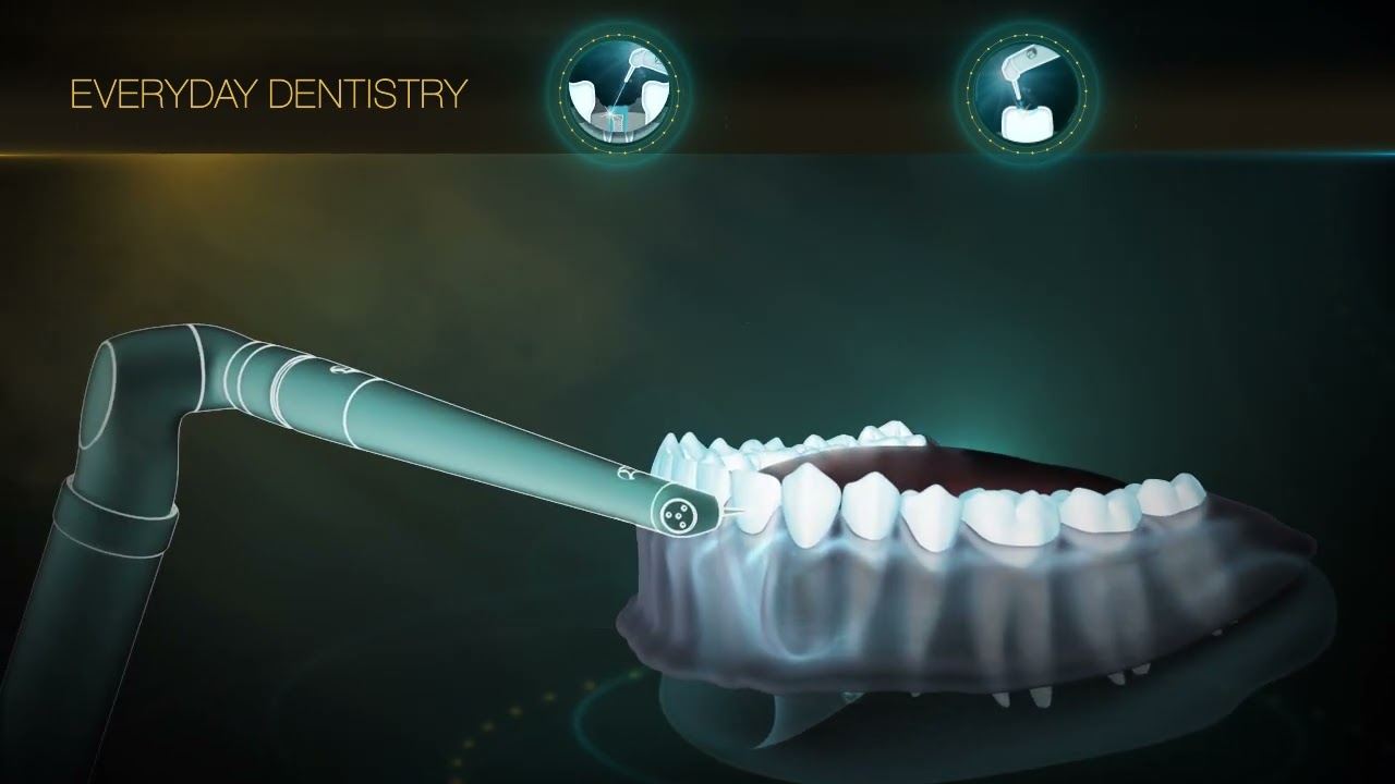 LiteTouch™ - An Er:YAG Dental Laser for treating both hard and soft tissues.
