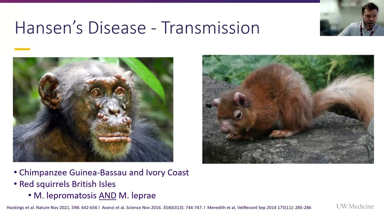 4/1/25 ID for Allergists: Hansen's Disease and paradoxical immune reactions to infectious diseases
