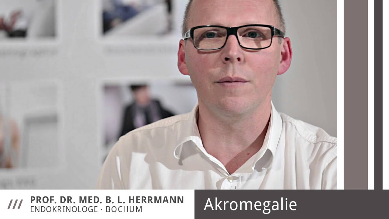 Akromegalie /// Prof. Dr. med. Herrmann, Endokrinologe Bochum