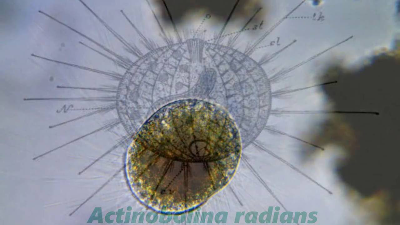 Actinobolina radians -- a ciliate that looks like a heliozoan
