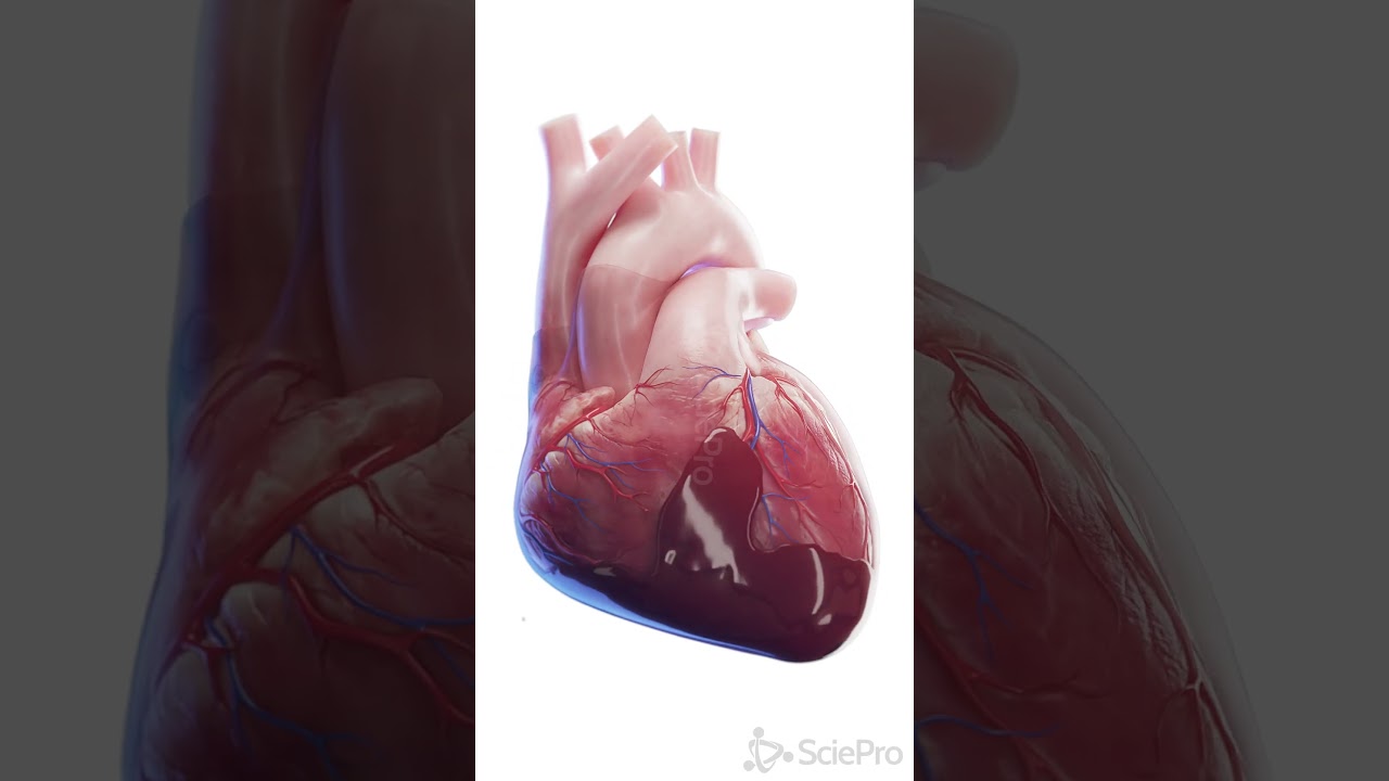 💓 Cardiac Tamponade: A Life-Threatening Condition 💓 #anatomy