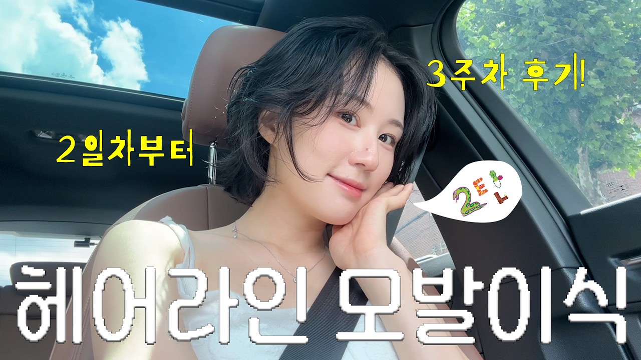 헤어라인 모발이식 리얼후기 2탄✨ 2일차~3주차 변화 총정리 (가장 중요한 시기!)