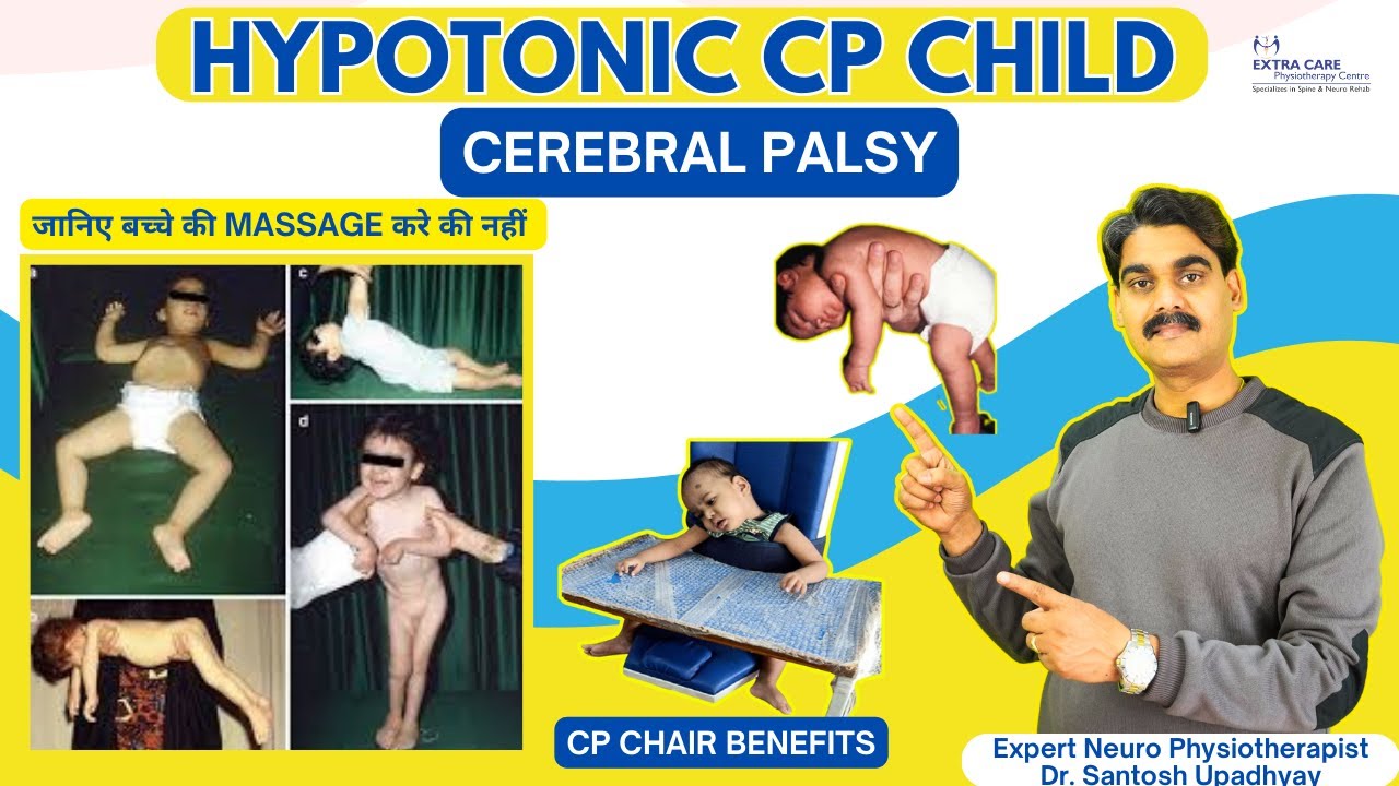 Hypotonic CP Child | Types of Cerebral Palsy | Extra Care Lko 94555 55207