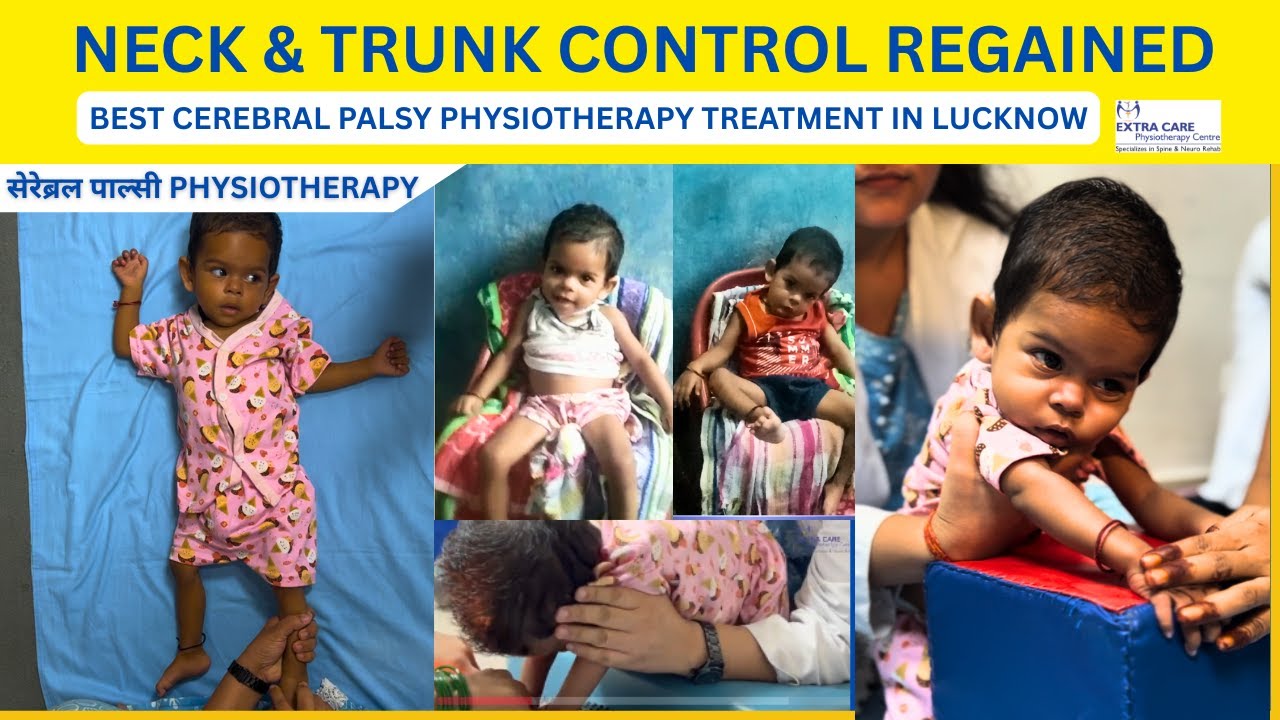 Neck & Trunk Control | Cerebral Palsy Best Physiotherapy Treatment