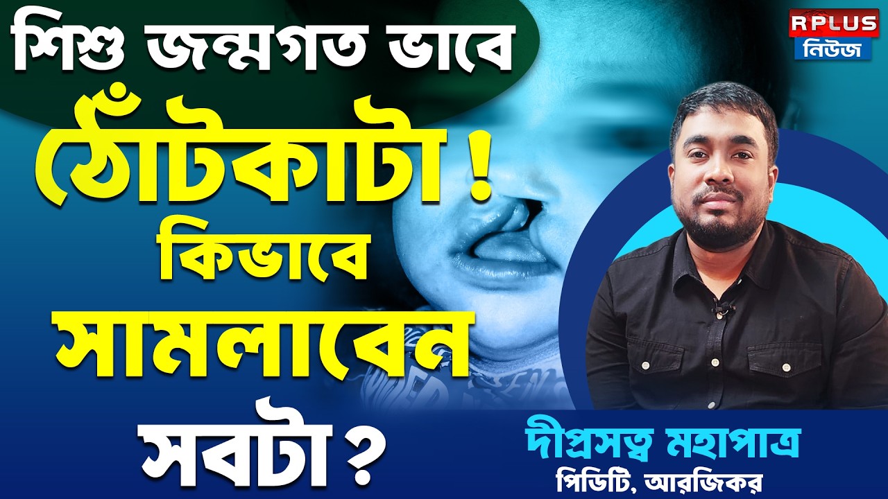 শিশু জন্মগত ভাবে ঠোঁটকাটা ! কিভাবে সামলাবেন সবটা ? |Cleft Lip Treatment | Health Plus | Health Tips