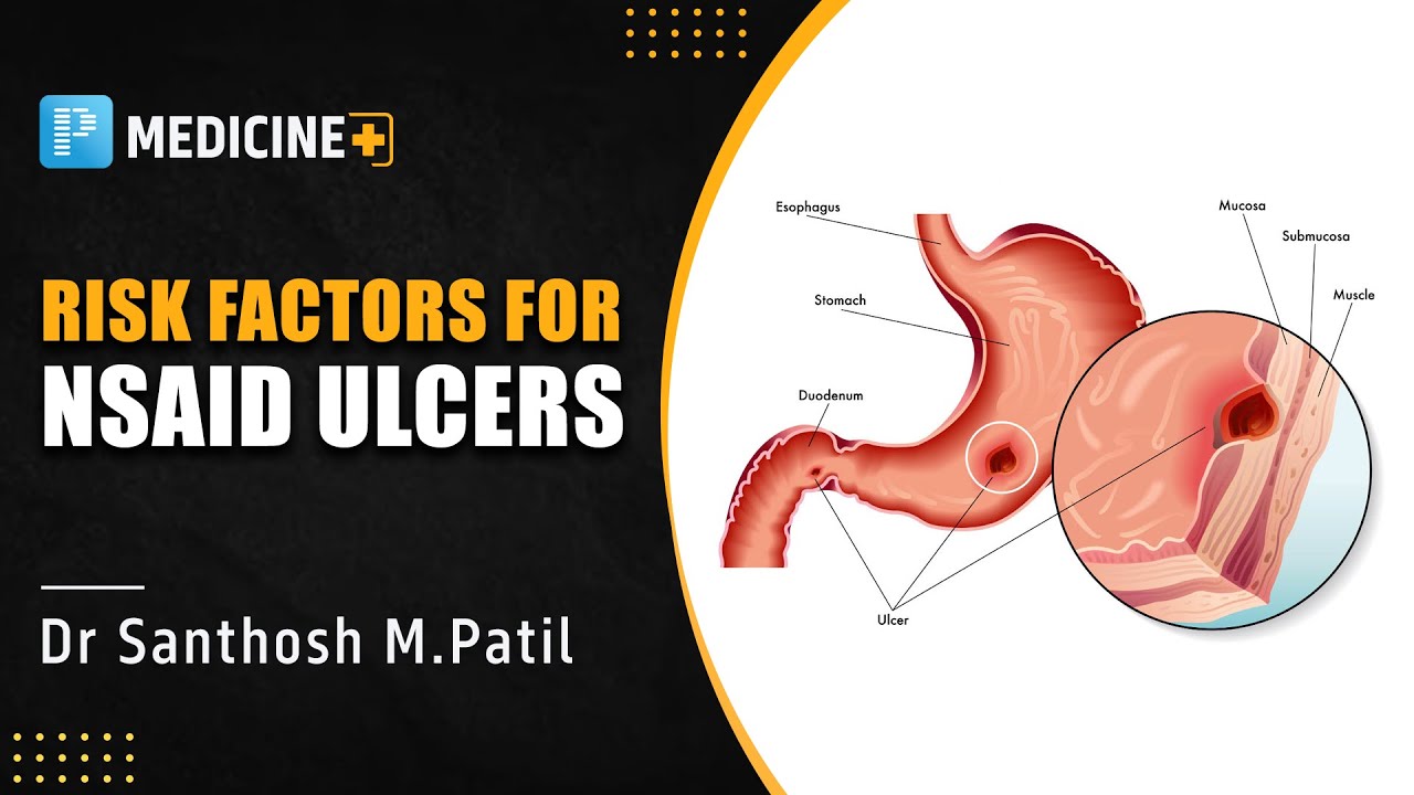 Risk Factors for NSAID Ulcers by Dr. Santhosh M. Patil | Medicine NEET SS