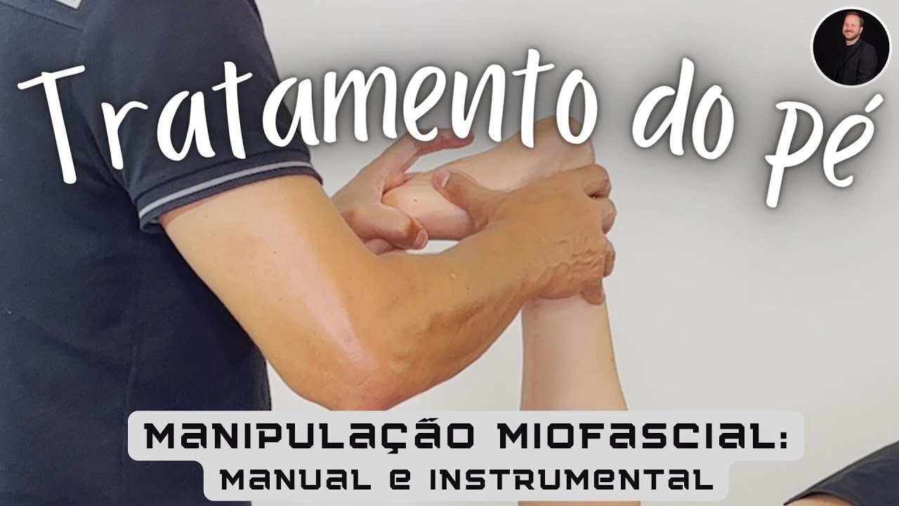 Tratamento das disfunções do pé com Manipulação Miofascial: Fascite, Neuromas, Hálux valgo e esporão