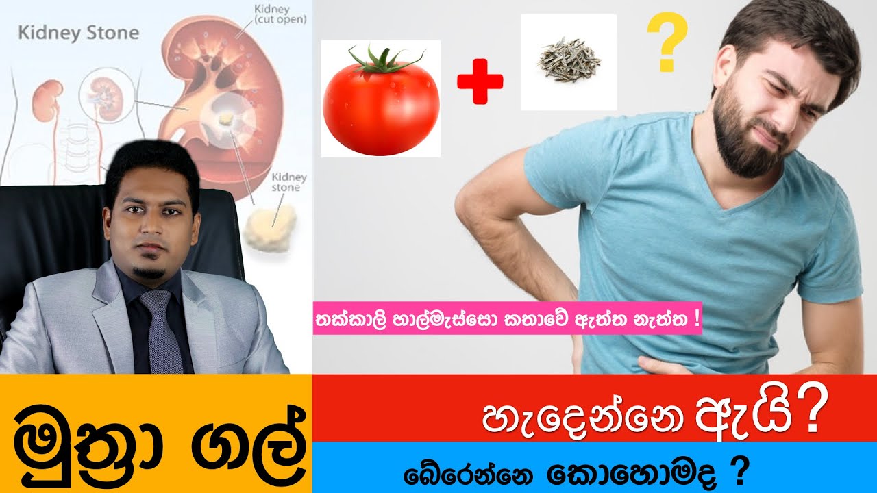 මුත්‍රා ගල් ගැන හැම දේම | Kidney Stones By Nutritionist Hiroshan Jayaranga
