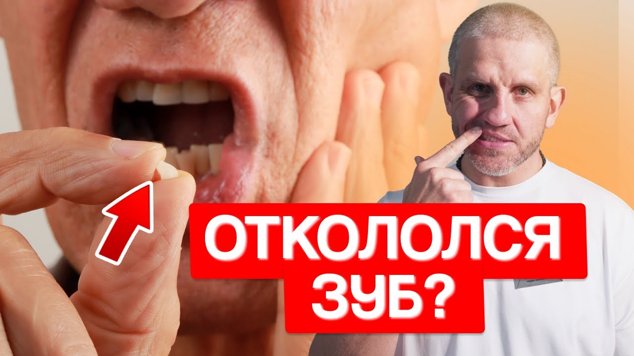 СРОЧНО сделай эти шаги, если ОТКОЛОЛСЯ КУСОЧЕК ЗУБА!