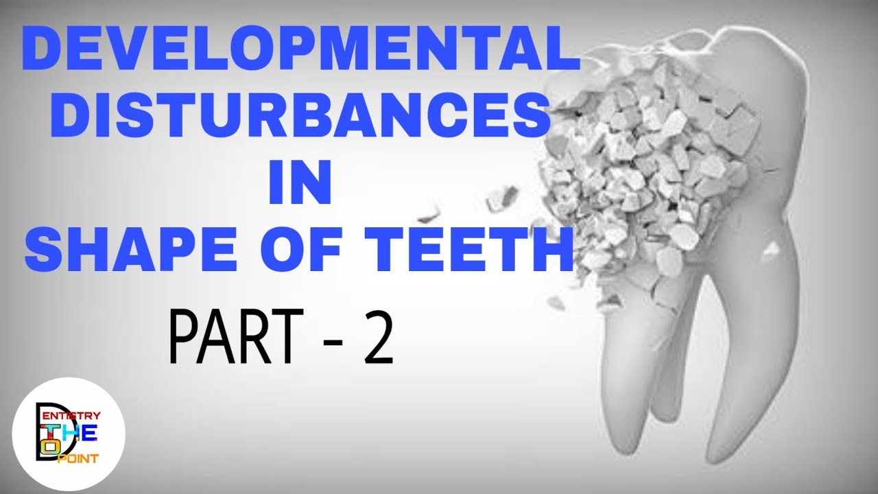 DEVELOPMENTAL DISTURBANCES IN SHAPE OF TEETH PART -2