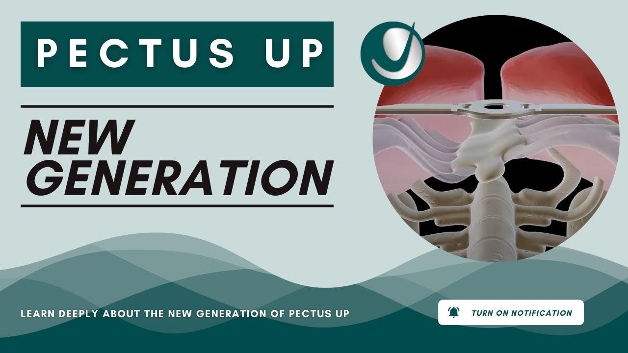 Pectus Up® - Pectus Excavatum Surgical Procedure