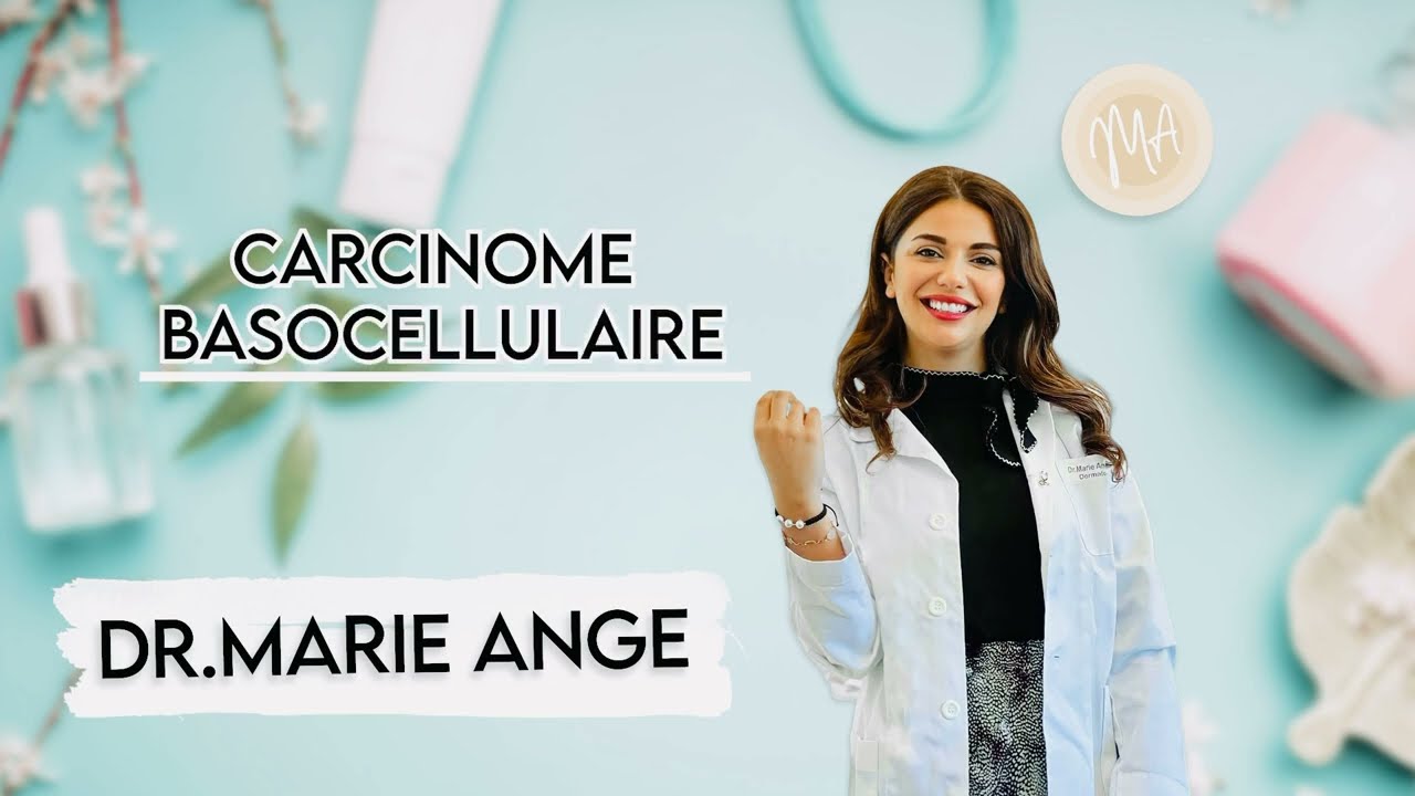 Carcinome basocellulaire: cancer de peau le plus fréquent