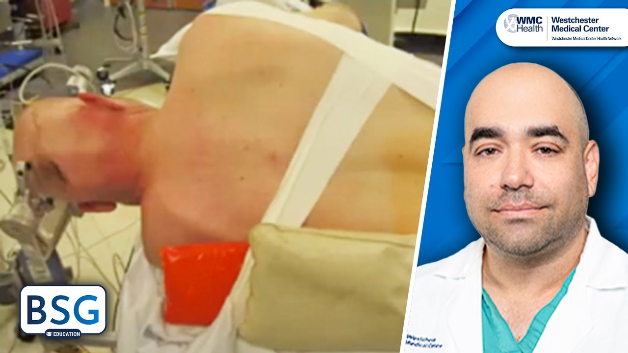 Retrosigmoid Craniotomy: The Basics