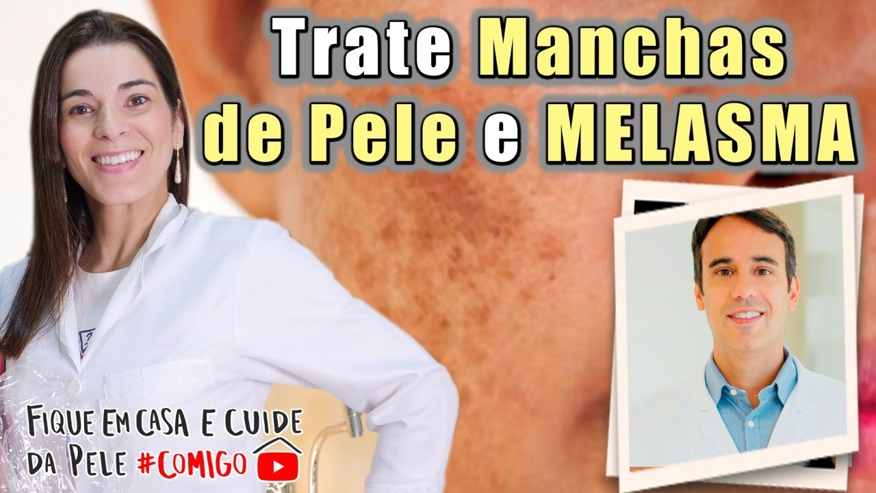 Saiba como Clarear e Tratar MELASMA e outras MANCHAS NA PELE #FiqueEmCasa e Cuide da Pele #Comigo