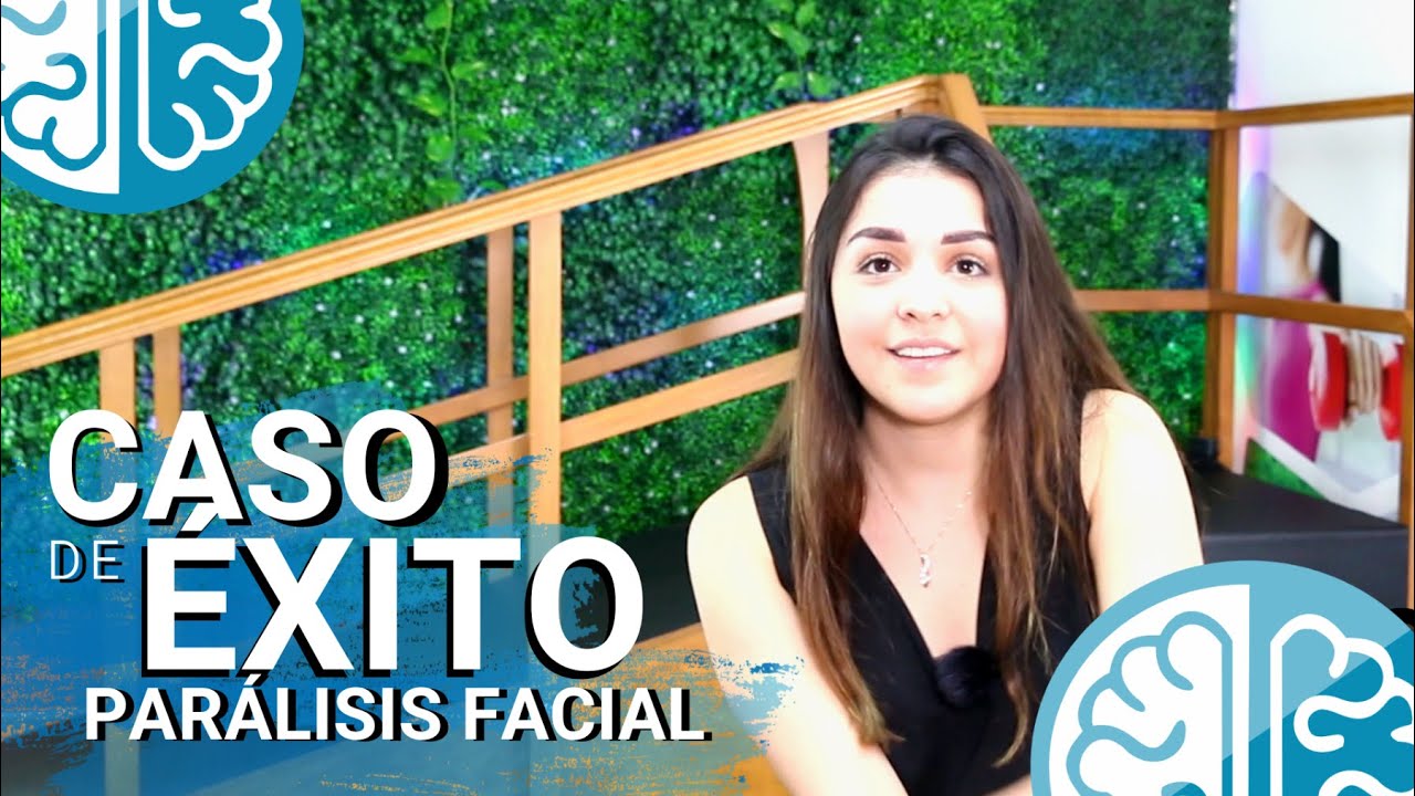 ¡CASO DE ÉXITO! PARÁLISIS FACIAL 👉 Especialistas en Fisioterapia para Parálisis de Bell Guadalajara