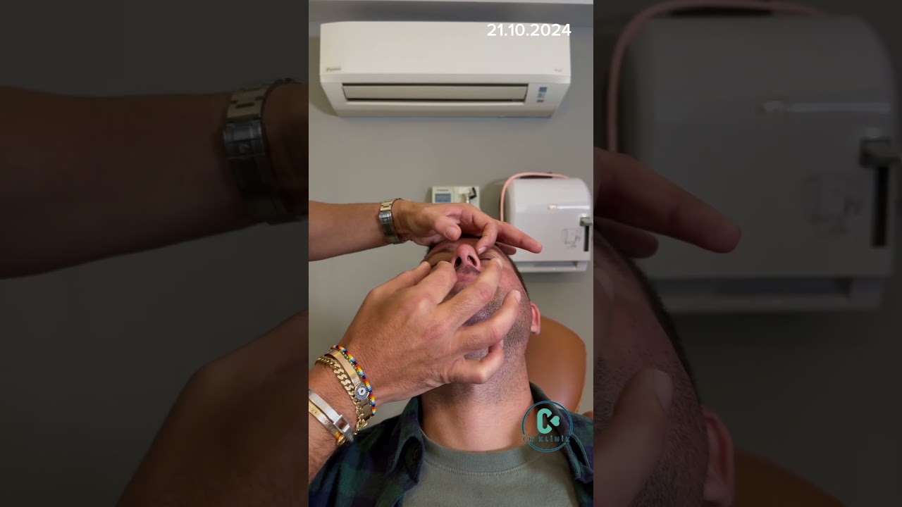 Deviasyon ameliyatları