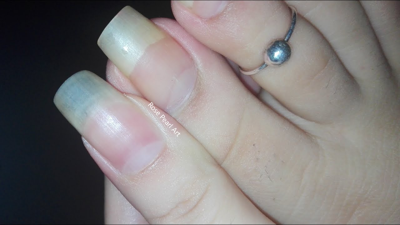 My Toe Nails are as Long as my Finger Nails- Nail Growth Tips
