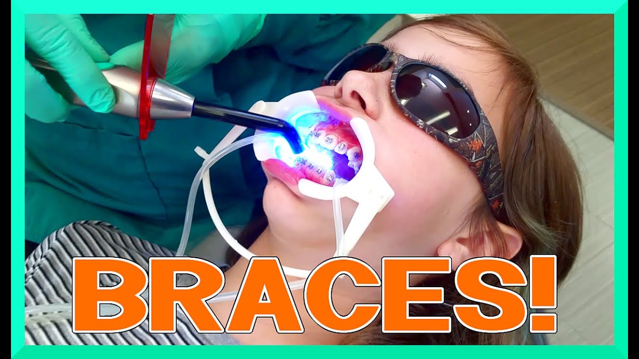 AUDREY Gets Her BRACES on! - Kid VLOG - PAIN?