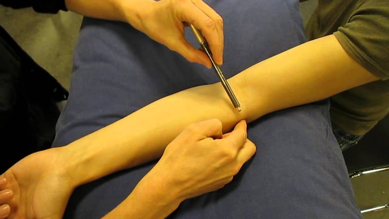 Surface Anatomy: Elbow Joint Line