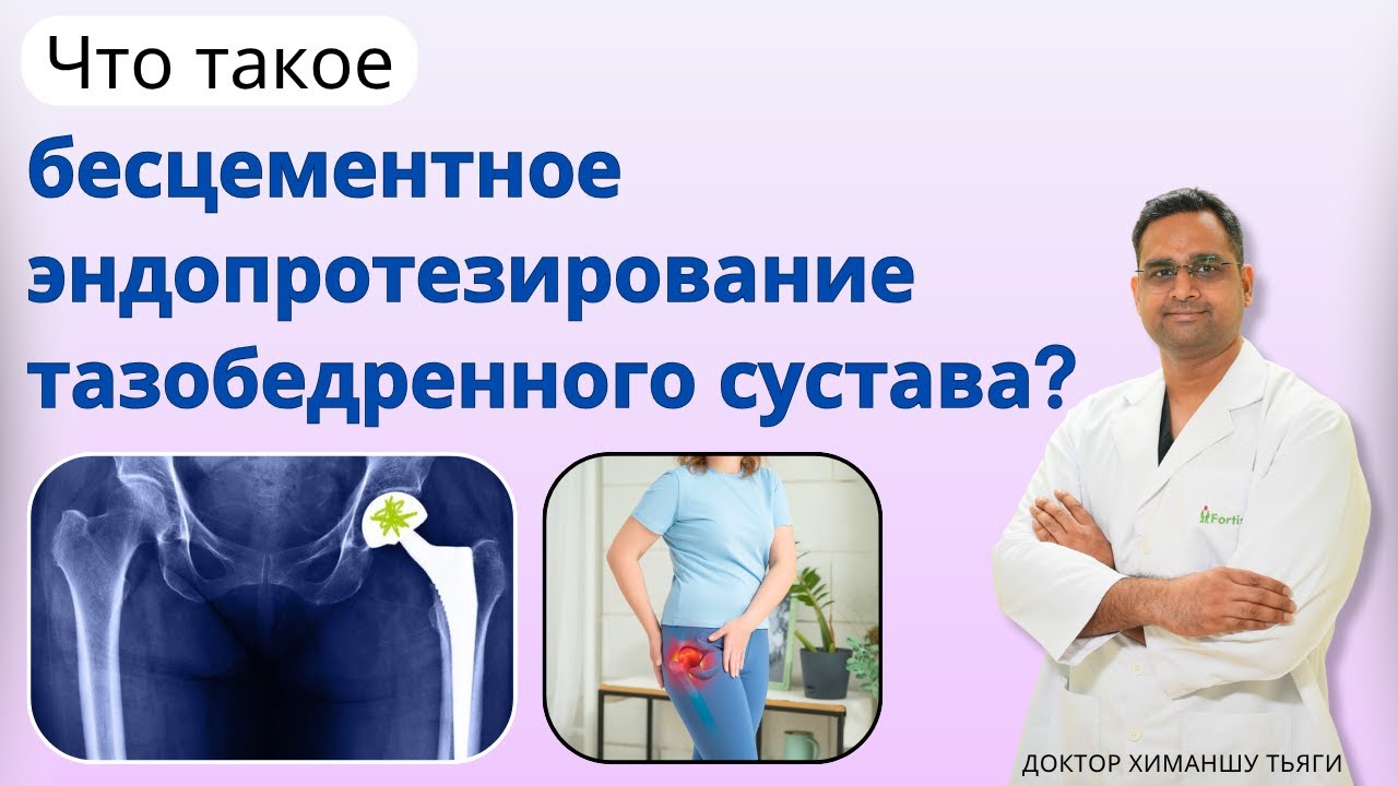 Что такое операция по замене тазобедренного сустава без цемента? Hip replacement surgery in Russian 