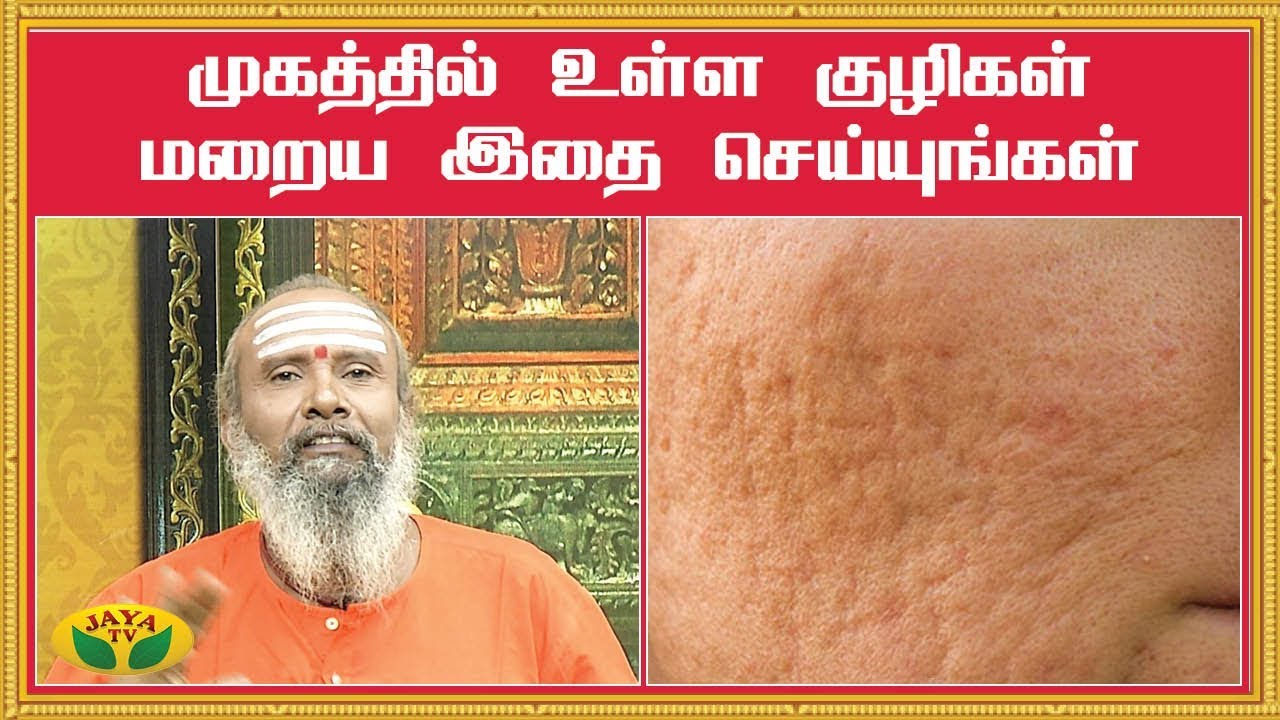 முகத்தில் உள்ள குழிகள் மறைய இதை செயுங்கள் | Open Pores Remedy | Parampariya Vaithiyam | Jaya TV
