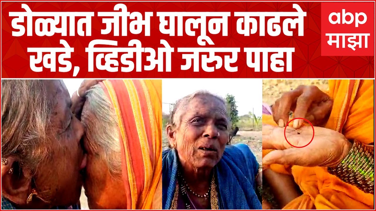 Eye Cleaning With Tongue : डोळ्यात जीभ घालून खडे काढण्याची कला,  75 वर्षीय आजीकडे रांग