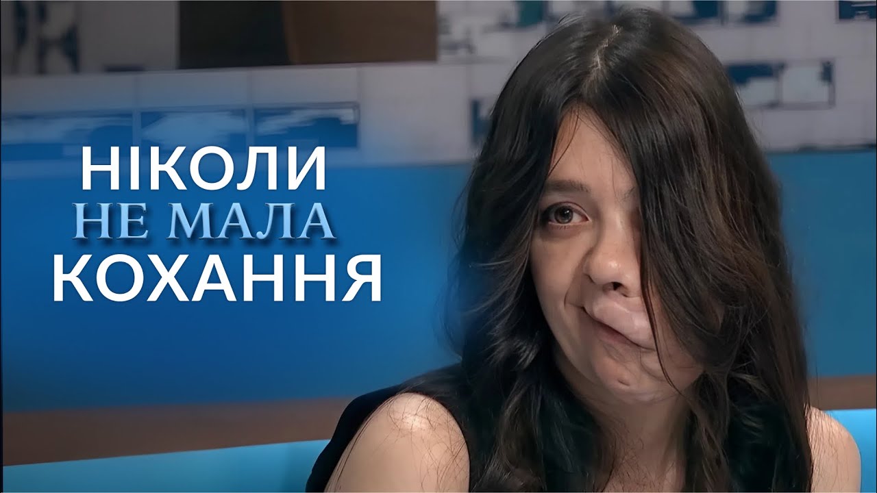 ЇЇ бояться навіть ДІТИ! Чому в очах людей вона виглядає МОНСТРОМ? 