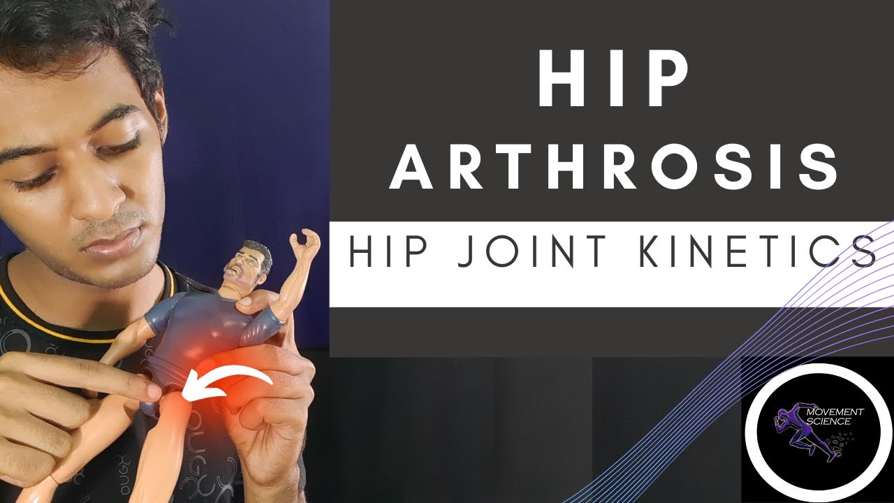 HIP JOINT ARTHROSIS (HIP  COMPLEX BIOMECHANICS)Physiotherapy Tutorial