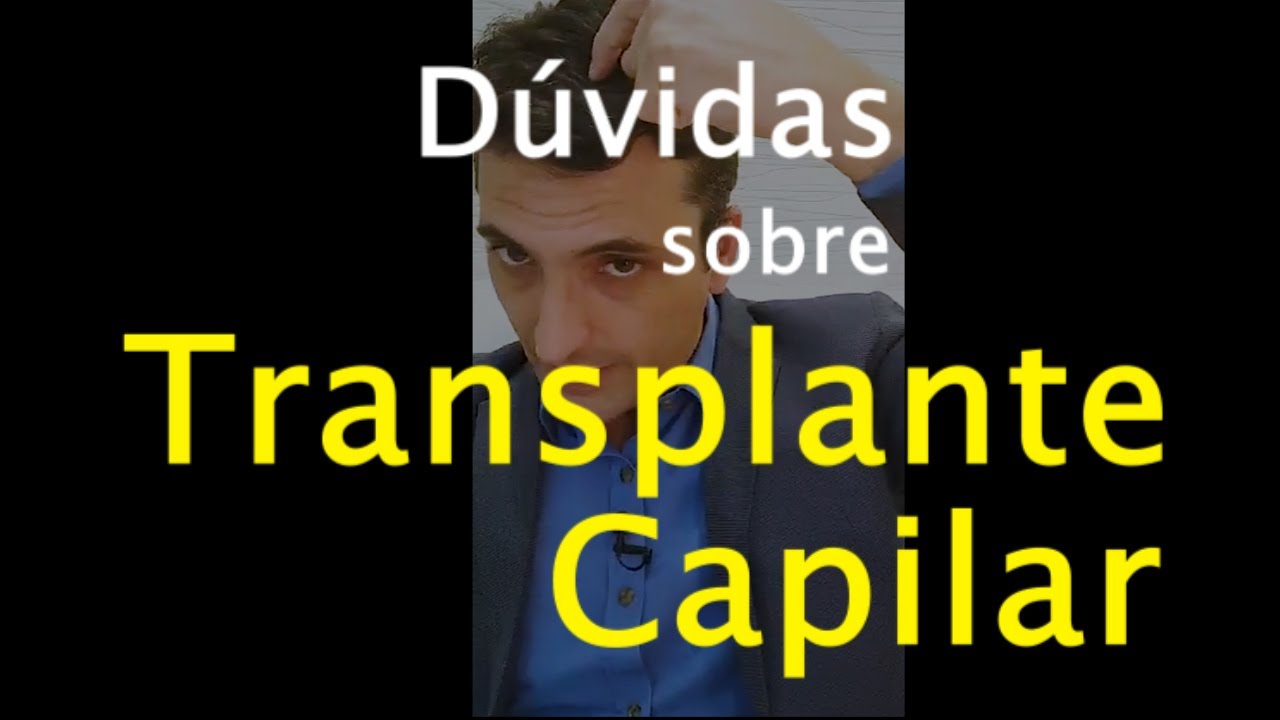 [ Transplante Capilar ] - Perguntas e Respostas