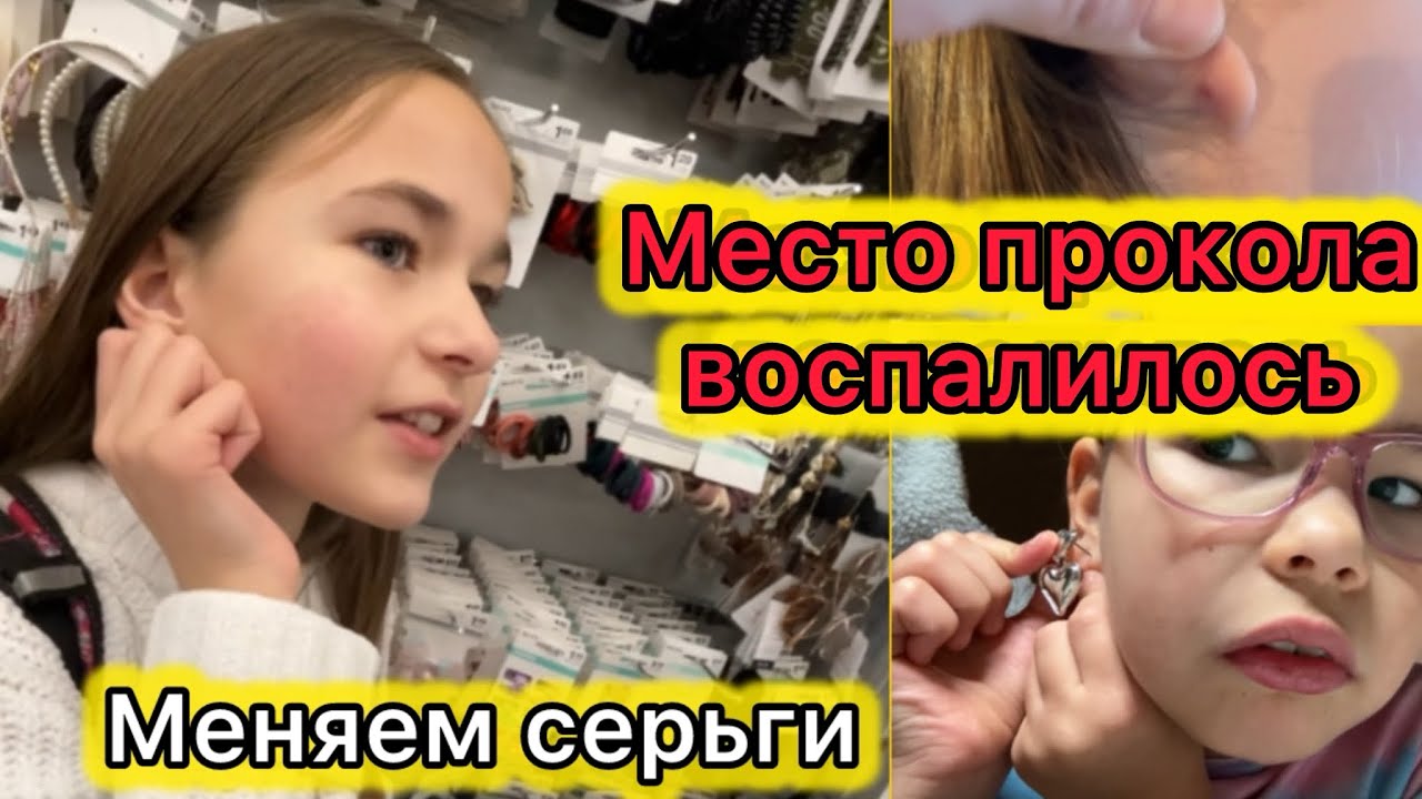 VLOG место прокола воспалилось. Меняем серьги