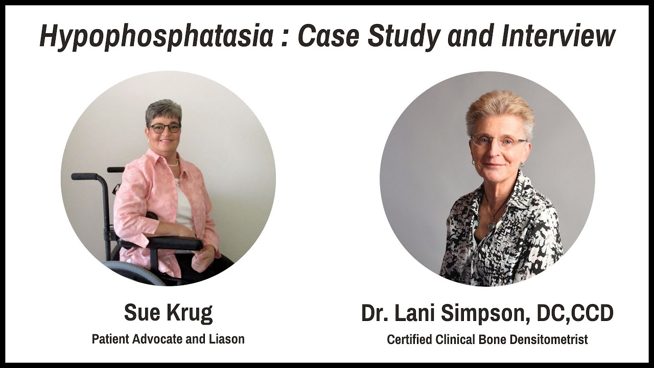 Hypophosphatasia : Sue Krug  Case Study and Interview