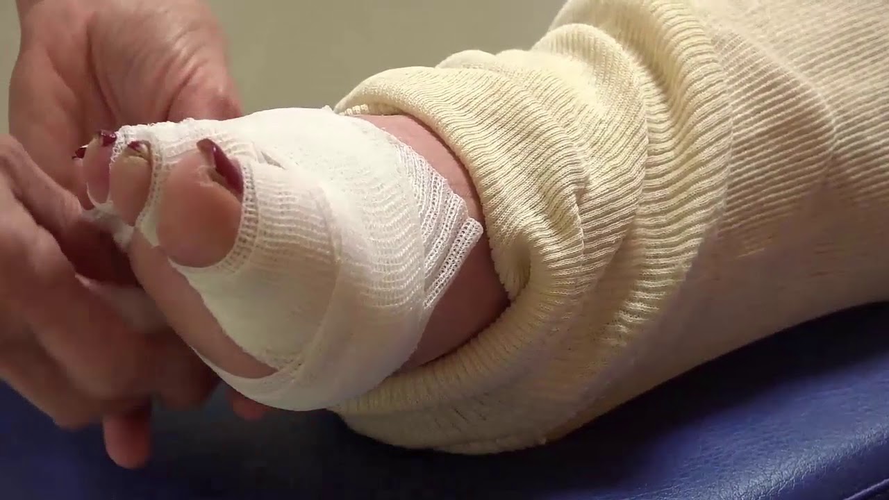 MI | Pose d'un bandage multicouches compressif