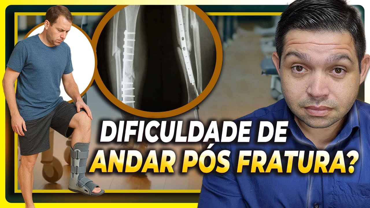 DIFICULDADE DE VOLTAR A ANDAR APÓS FRATURA É NORMAL?