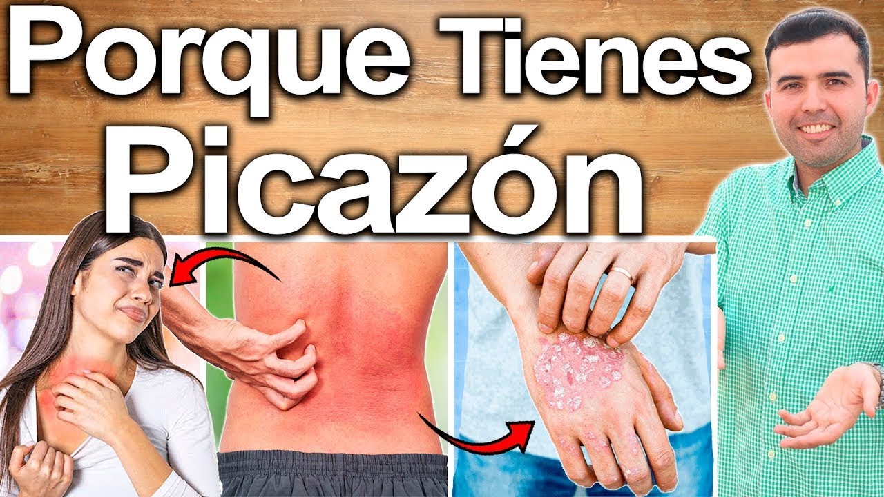 Porqu&eacute; Me Pica La Piel? - Causas Y Soluciones Para Eliminar La Picaz&oacute;n