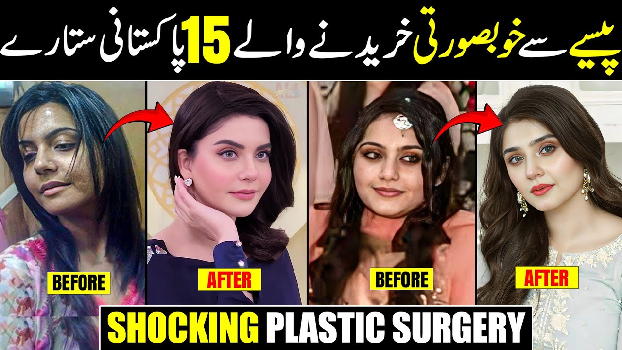 15 Pakistani Celebrities Who Transformed Their Faces with Plastic Surgery! Shocking Surgeries