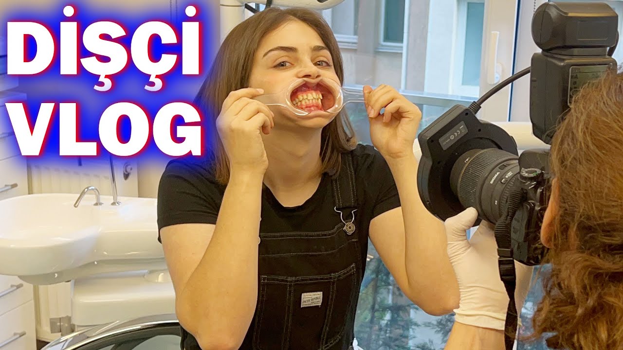 DİŞ TELİ TAKTIRIYORUMMM!! EYVAH DİŞÇİ !! Bu nasıl bir şey !?