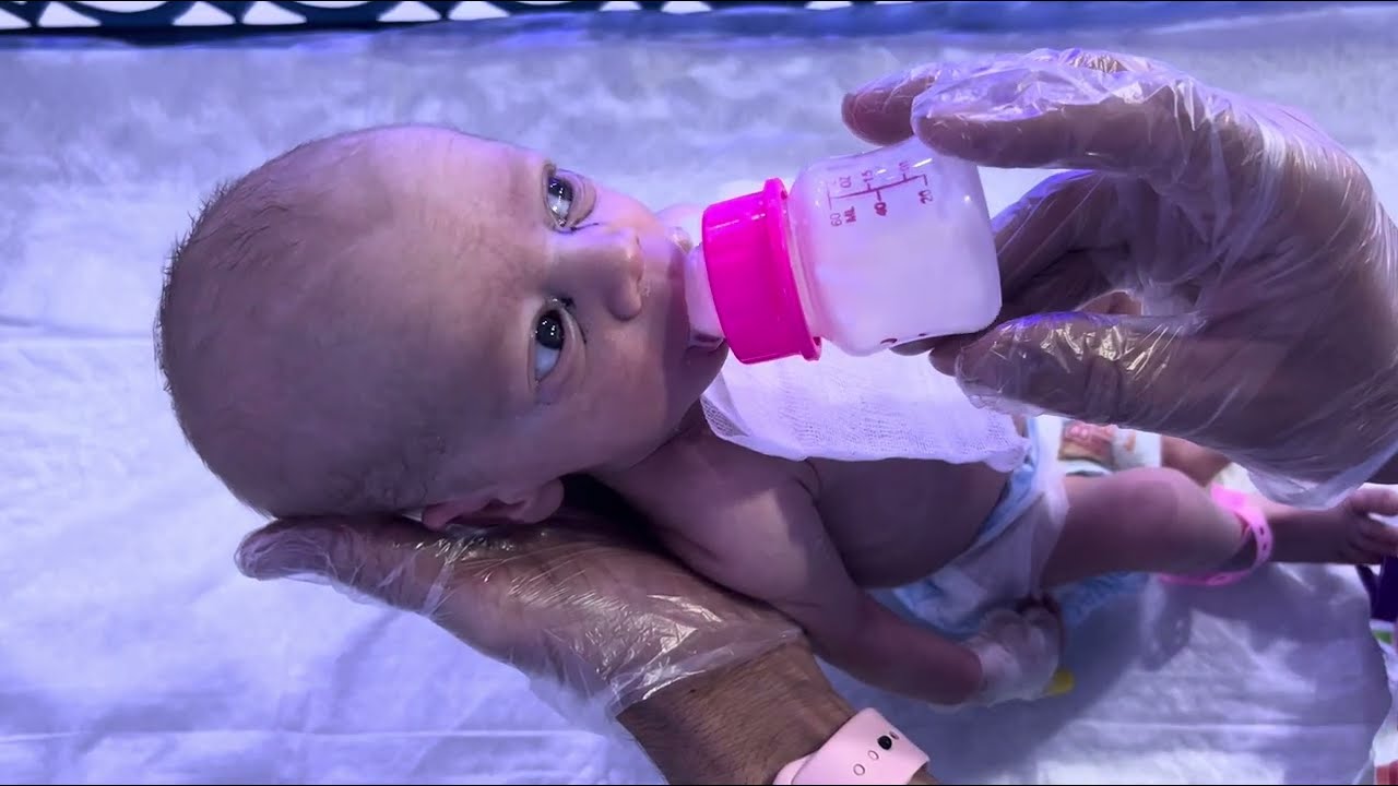 Baby Condition Improved | Feeding Well | NICU Baby Quick Recovery Update 👶