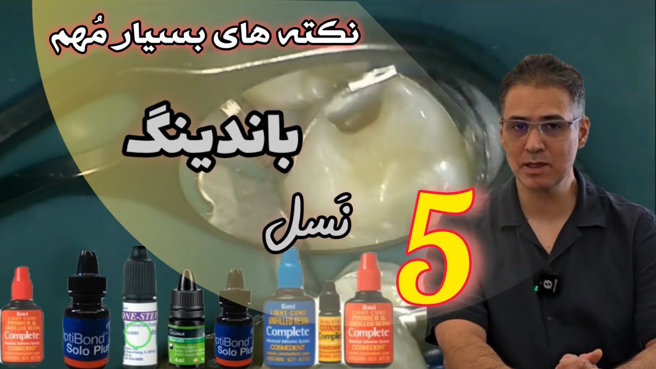 همه نکات مهم و مورد نیاز درباره کاربرد باندینگ نسل پنج که هر دندانپزشکی باید بداند.