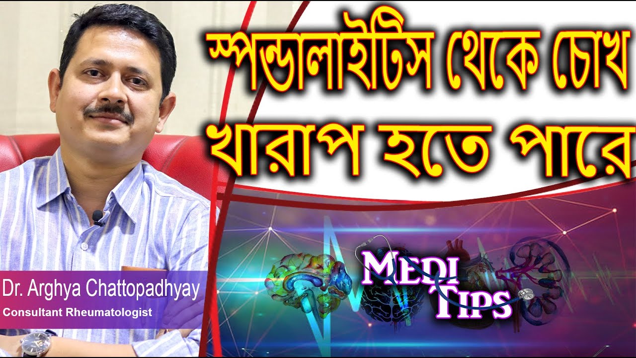 Understanding Spondylitis: Symptoms, Causes & Challenges || Dr. Arghya Chattopadhyay || Rheumatology