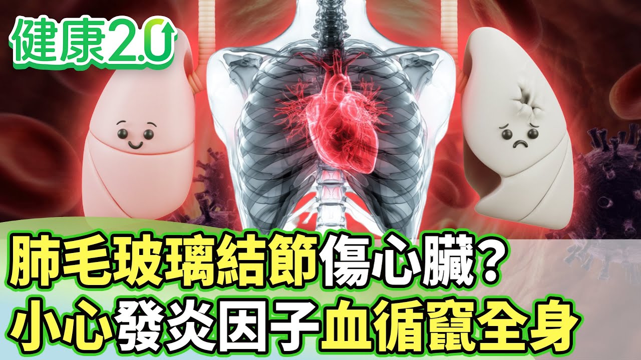 肺毛玻璃結節傷心臟？小心發炎因子血循竄全身【健康2.0分段】@tvbshealth20 EP3163-1 20260124 #鄭凱云#蕭世欣#陳冠任#陳潮宗#洪素卿#李筱娟