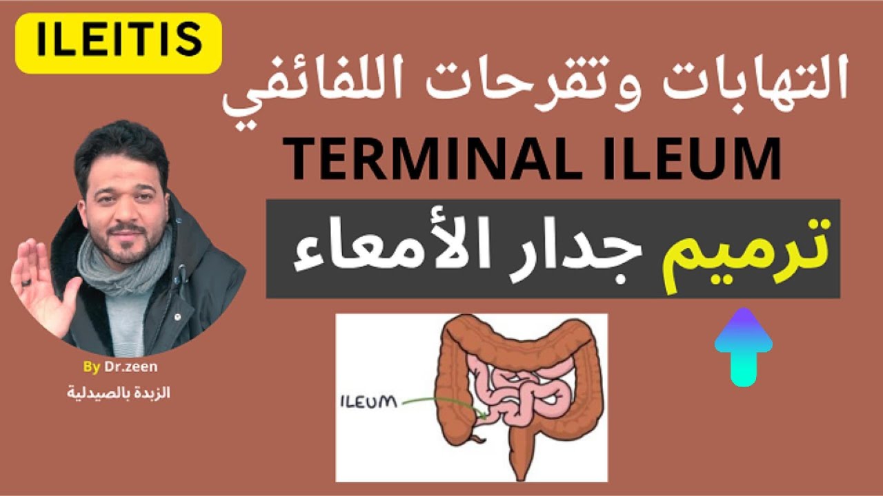ترميم جدار الأمعاء | من الالتهابات والتقرحات إلى الشفاء | د. محمد زين