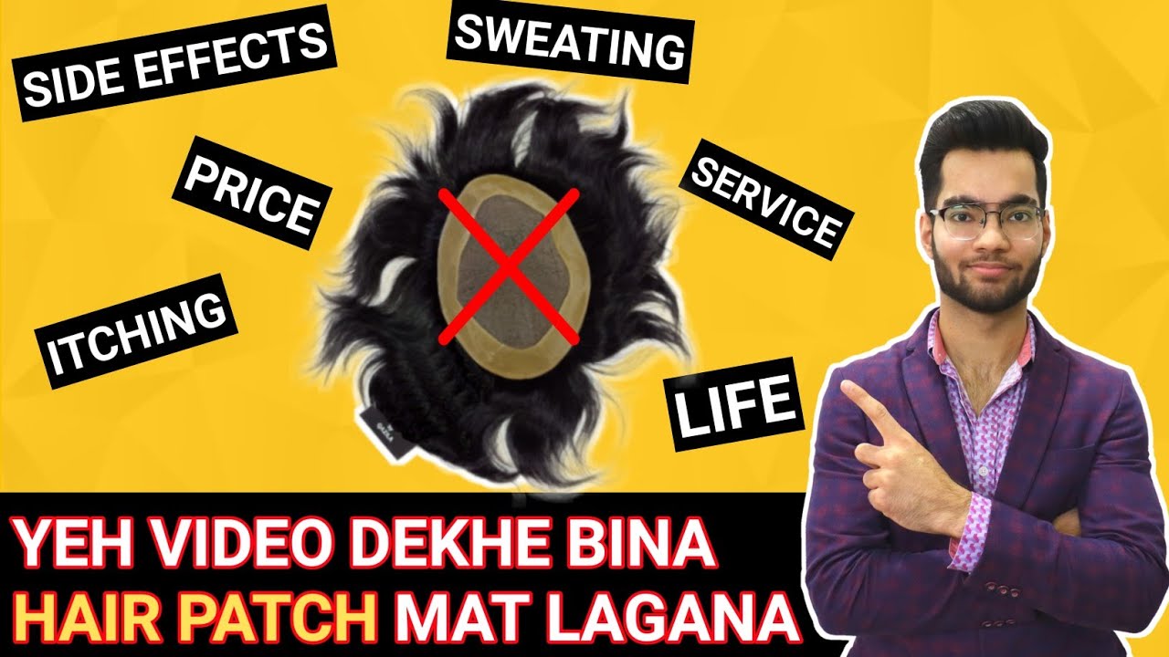 Yeh video dekhe bina hair patch mat lagana| Full info about hair patch