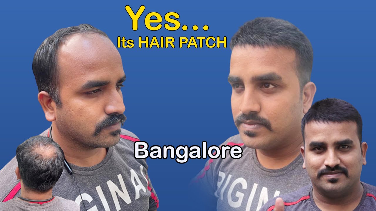 Hair patch for men | Short hair style video | Hair fixing in Bangalore | Call 9110221804/ 9742549827