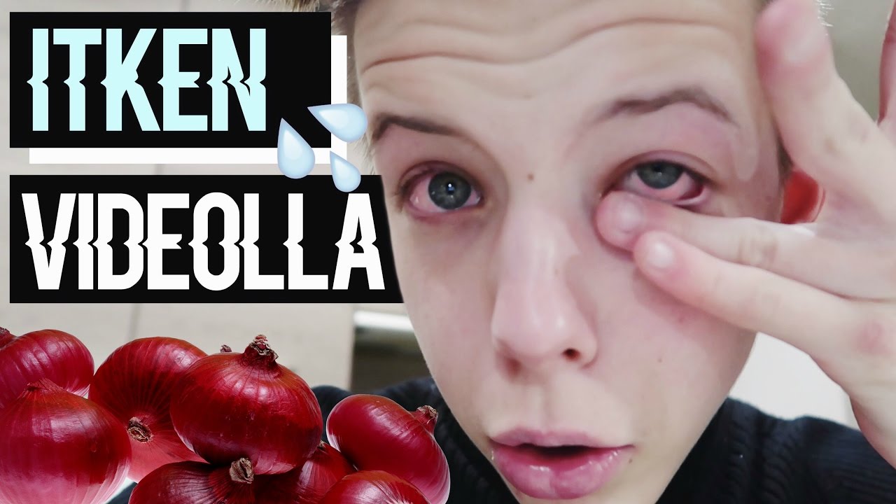 SKANDAALI KEITTIÖSSÄ! 💥🆘