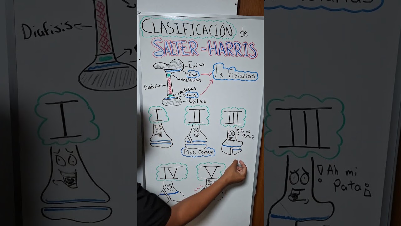 CLASIFICACI&Oacute;N -SALTER HARRIS- 🦴#fisiologia #bajavets #vetlife #veterinario #vetmed #veterinariaa