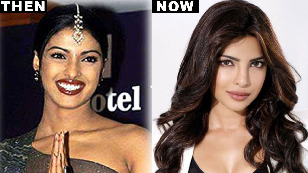 Has Priyanka Chopra done a NOSE job ?