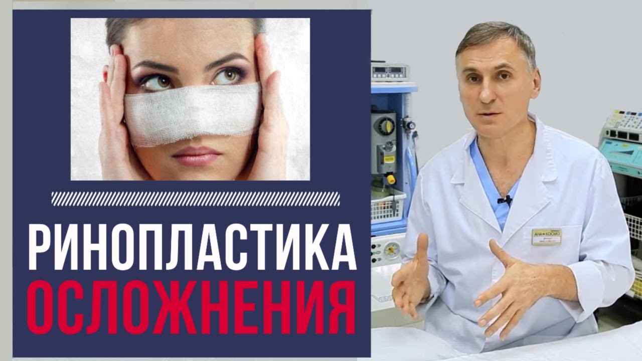 РИНОПЛАСТИКА: 🆘Осложнения | Чего бояться пациенту?
