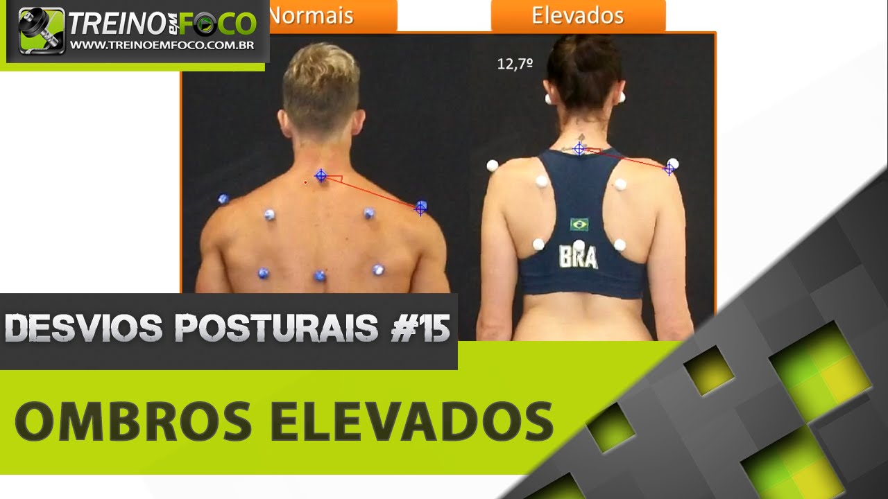Ombros Elevados - Desvios Posturais #15