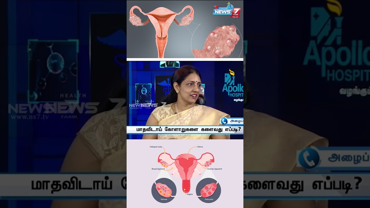 PCOS நினைத்து பயமா? | Dr.Sowmiya Ragavan
